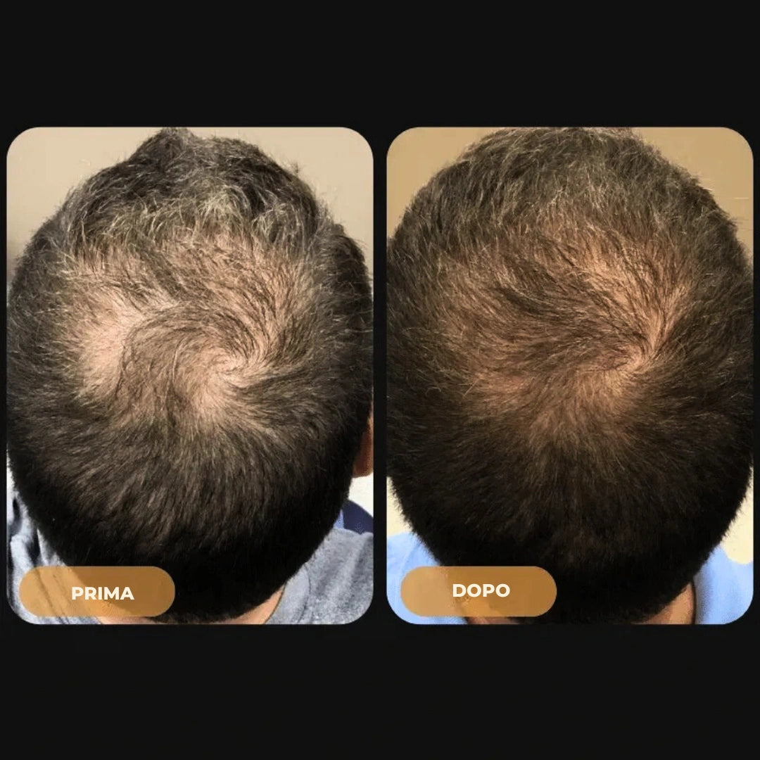 Hairzen Hair Root Shampoo