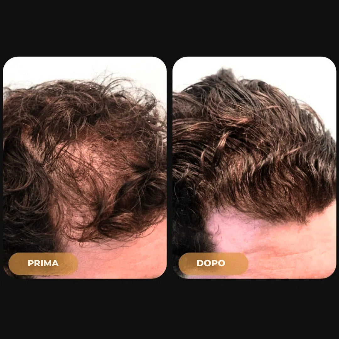 Hairzen Hair Root Shampoo