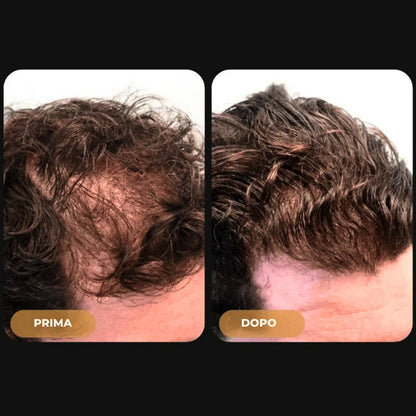 Hairzen Hair Root Shampoo