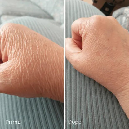 Mokio – Novaderm Crema Riparatrice Corpo