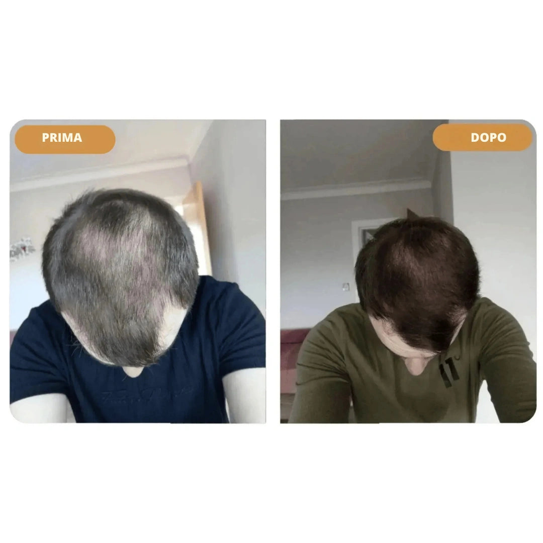 Hairzen Hair Root Shampoo