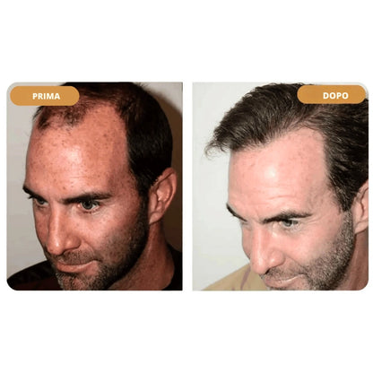 Hairzen Hair Root Shampoo